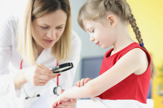How to treat and control eczema in children