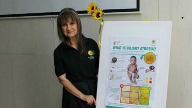 Chris Hani Baragwanath Hospital, paediatrics and child health, Dr Christina Hajinicolaou unveils the biliary atresia awareness poster. Photo: Asanda Matlhare