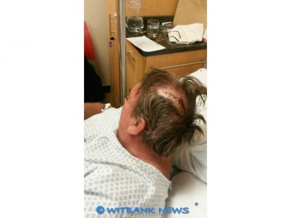 Mnr. Frik Bodenstein is drie keer oor die kop geslaan met die plat deel van ’n panga. 