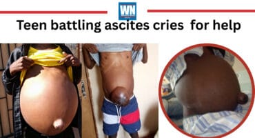 Kwa-Guqa teen struggling with ascites.
