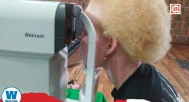 Learners living with albinism took a powerful step toward a brighter future on April 7, receiving essential eye testing and health support.