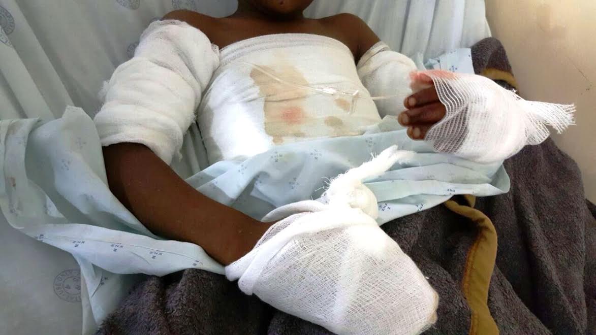 Child critically injured in explosion | Rising Sun Newspapers