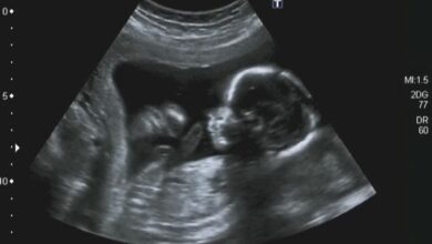 Can an ultrasound at birth reveal autism risk?