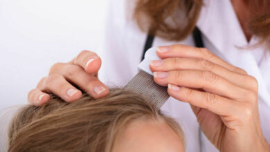 Dealing with head lice in children: Tips for parents
