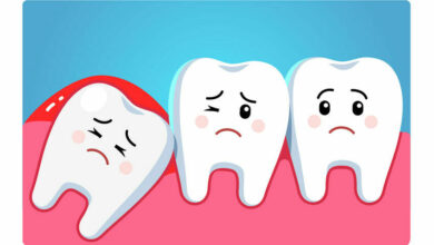 Help: My child has an abscessed tooth!