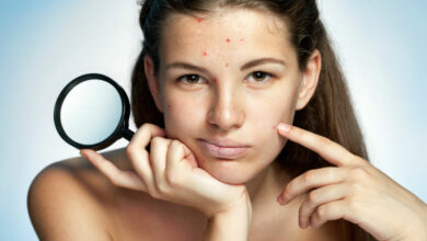 How a healthy lifestyle can change your teen’s skin!