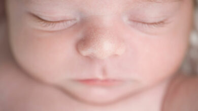 Milia in babies: What is it and how can you treat it?