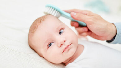Stress-free ways to remove your baby’s cradle cap