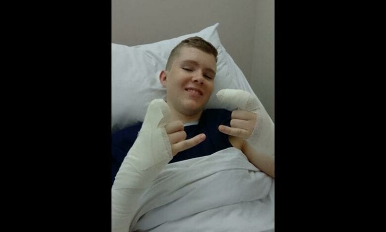 KZN brothers bitten by venomous stiletto snake