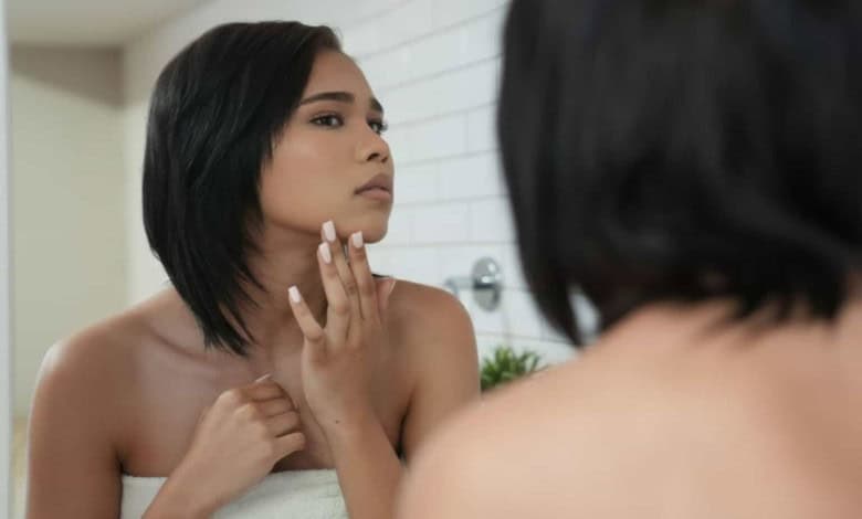 Social media is damaging teenage skin