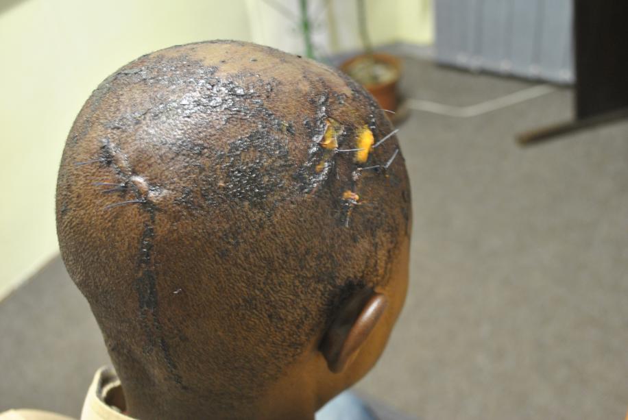 The victim sustained several head injuries