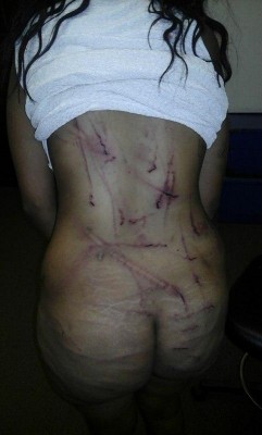 Girl shows brutality of pastor