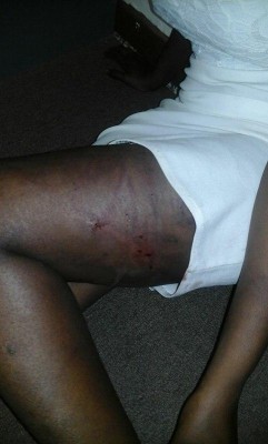 Victim's wounds