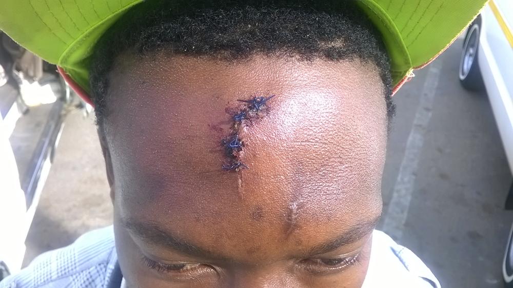 Pogiso Michael Mogapi was stabbed in his forehead, shoulder and back.