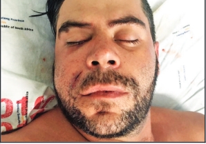 Morne Coertzen spent two days on a venti lator and was in the hospital for two weeks.