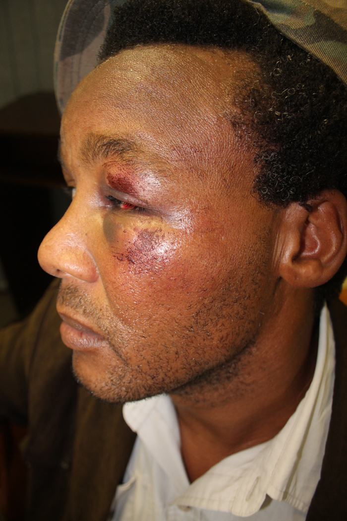 After the assault.