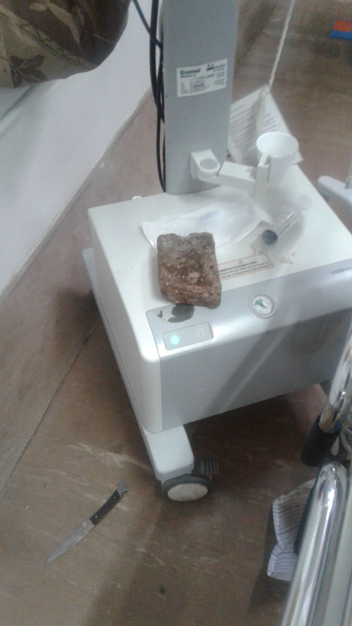 During the chaos, half a brick landed on the equipment next to Karabo's bed. The gangsters also left a knife behind.