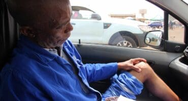 The resident shows how his leg was bruised during the fight. Photo: Adele Louw