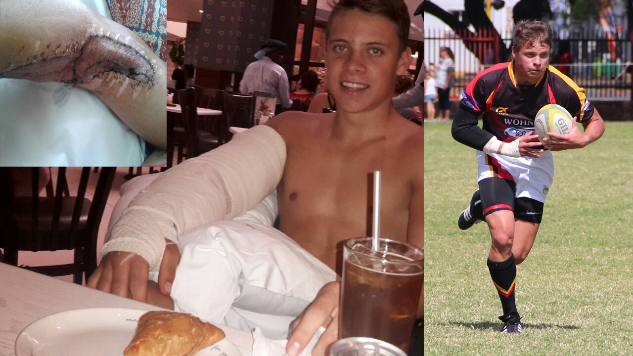 Die dokters het vir Volkies se hoofseun en eerstespan rugbykaptein gesê dat sy arm miskein afgesit moet word, nou speel hy weer rugby na 'n merkwaardige herstel.