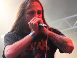 Vulvodynia