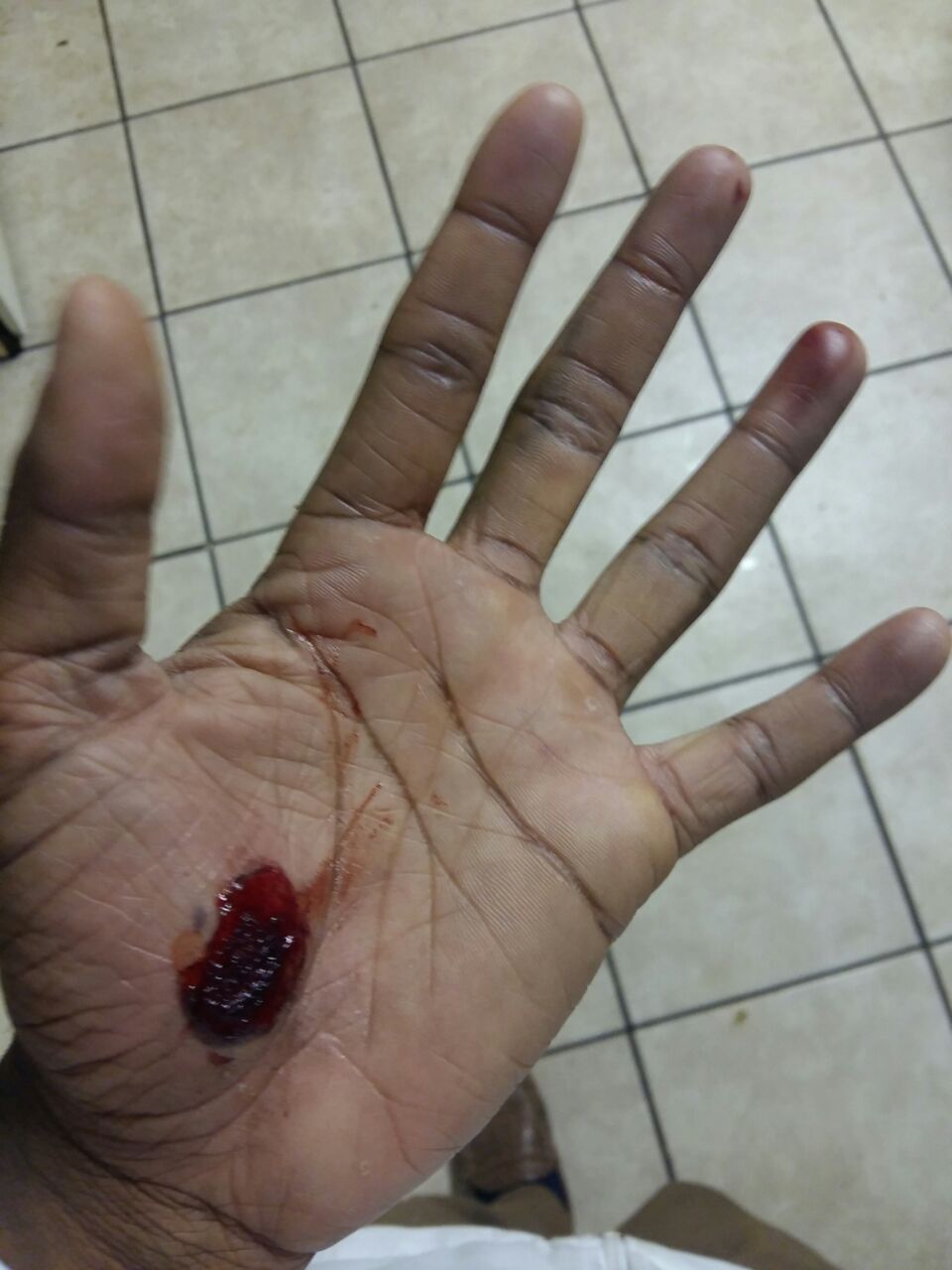 Daniel sustained scrape wounds after his fall.  Photo: Provided