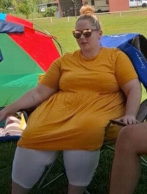 Obese person before life style changes