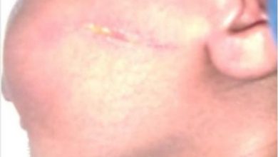 Newbornbabysuffered_52525