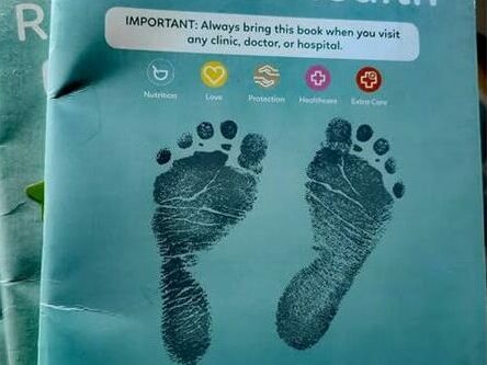 According to CoE spokesperson Zweli Dlamini, to date, there have been 80 confirmed cases of measles in Ekurhuleni, and this number continues to increase.