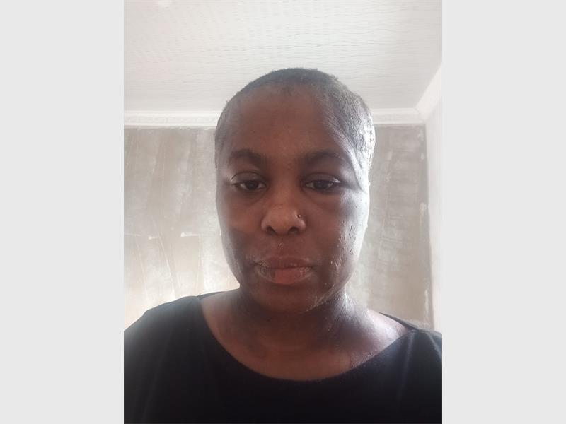 Despite numerous consultations with doctors and dermatologists, as well as several biopsies, her condition continued to deteriorate without a definitive diagnosis.