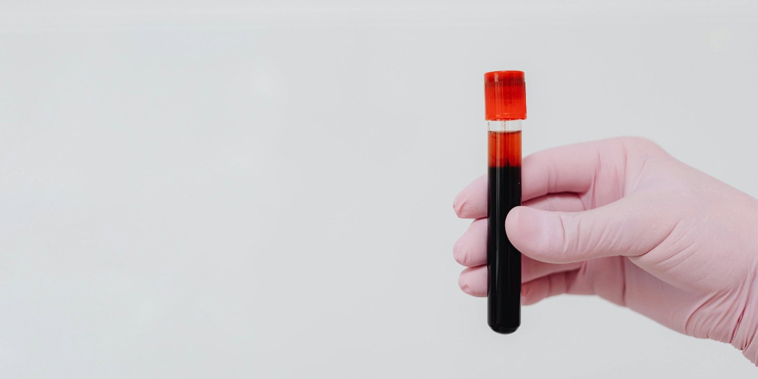 Blood cancer myths debunked on World Blood Cancer Day
