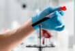 A medical professional holds a vile of blood for testing. Photo: Pexels