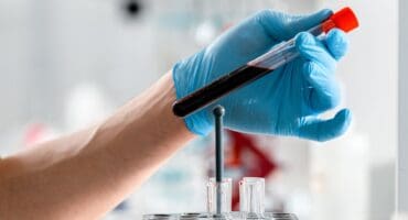A medical professional holds a vile of blood for testing. Photo: Pexels