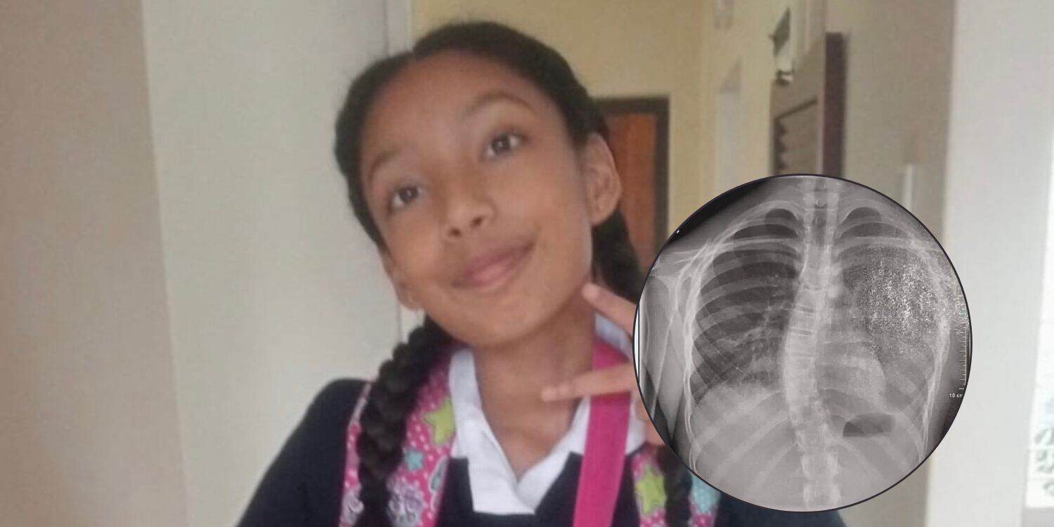 Teen battling epilepsy and scoliosis needs help for urgent surgery