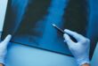 AI-powered TB screening project aims to transform diagnosis