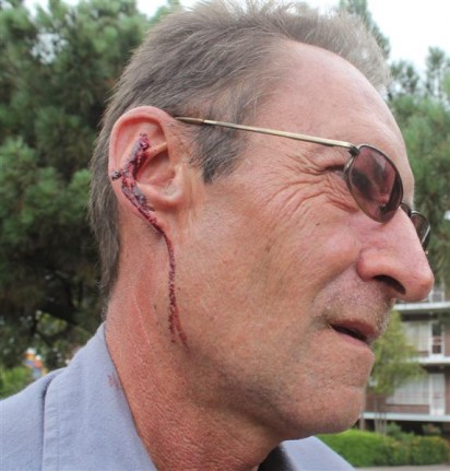 Rudy Olivier's right ear have been cut after protestors broke the windows of his employers vehicle in Kagiso.