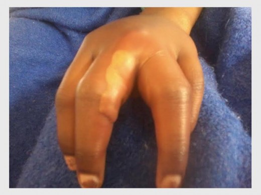 A 12-year-old girl's hand was broken after her teacher punished her with a steel pipe.
