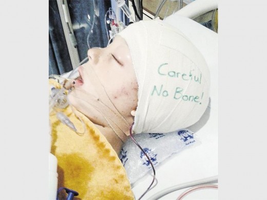Caden Slabbert in hospital after a brick through his father's car window hit him against the head.