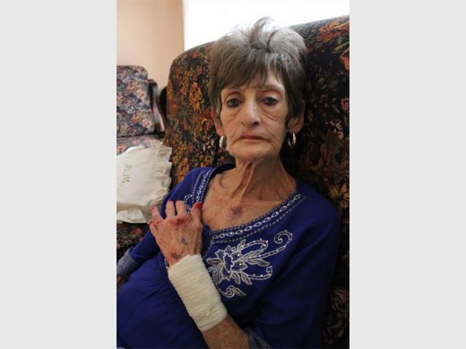 Marie Prinsloo kort nadat sy aangeval is.