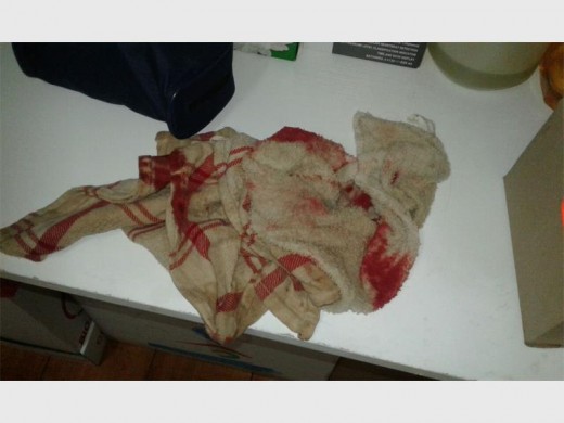 Hierdie lappe is gebruik is om Zander se wonde toe te draai. Foto ingestuur.
