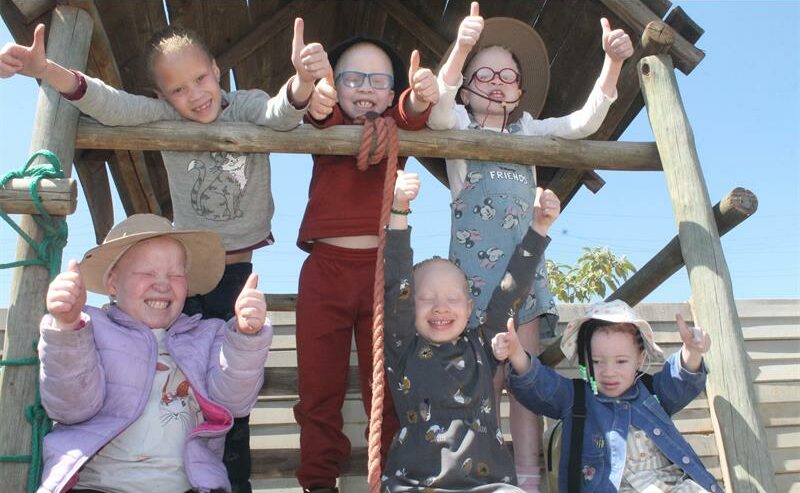 ASSA hosts support group meetings for parents of children with albinism every second week of the month at St John’s Anglican Church in Putfontein.