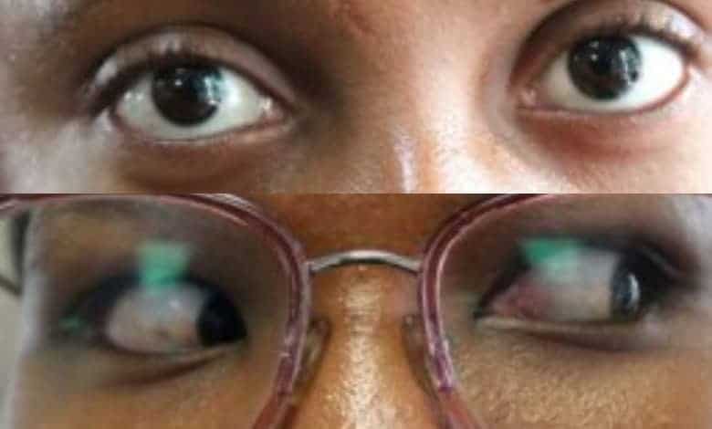 Dr Raman-Abdulla urges the public not to wait for vision problems to appear before seeking help.