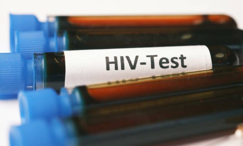 The Department of Health says the arrival of Lenacapavir marks a major step in expanding HIV prevention options.