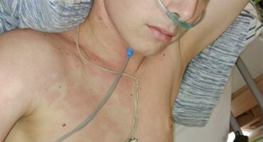 Photo of a young cancer patient.