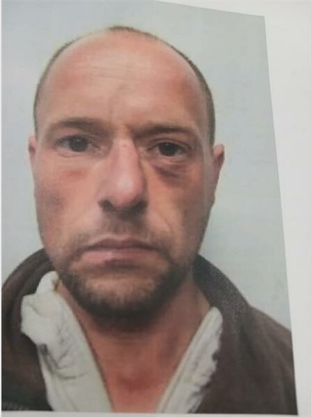 Mug shot of a bald white man with bruising under his left eye
