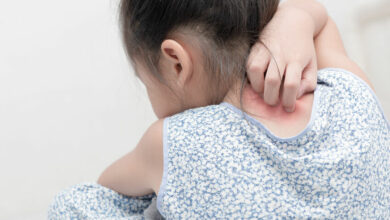 Dealing with skin rashes in children