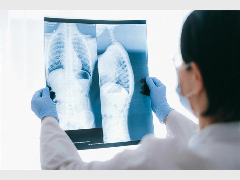 Pholosong Regional Hospital is assisting former mineworkers as part of the GDoH’s benefits programme.