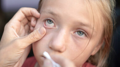 Help: My child has something stuck in their eye!