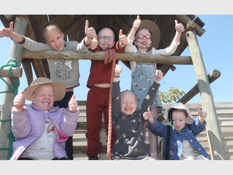 ASSA hosts support group meetings for parents of children with albinism every second week of the month at St John’s Anglican Church in Putfontein.