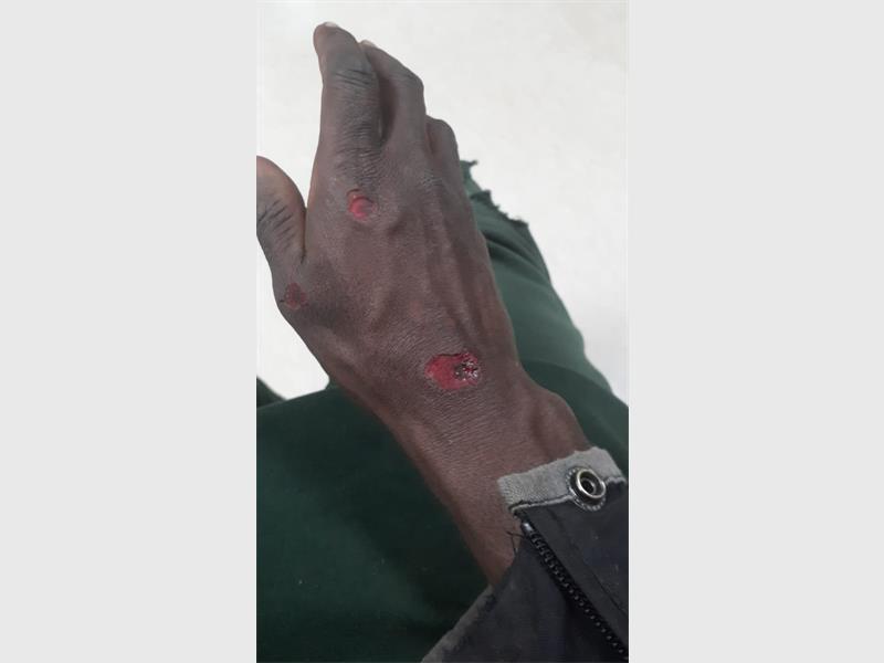 A 31-year-old delivery driver claims that the Springs police failed to open a case after he was assaulted by three men who tried to rob him of his bike.