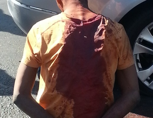 THE 22-year-old suspect and driver of the get-away vehicle was grazed by a bullet in the head, he has a warrant of a arrest against him and skipped his bail hearing.
